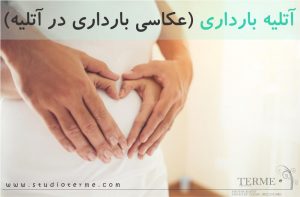 عکس بارداری - عکاسی بارداری - آتلیه تخصصی بارداری ترمه در تهران - آلبوم بارداری